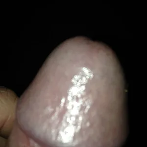 hairy gallery image
