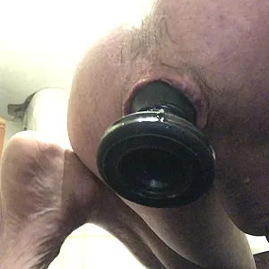 anal gallery image