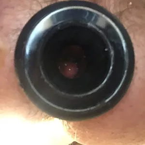 anal gallery image