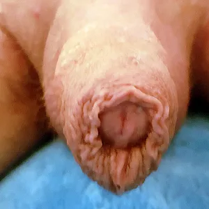 closeups gallery image