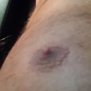Neuer cockring Galeriebild