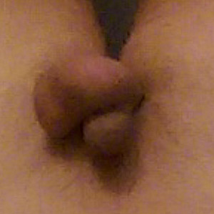 micro penis gallery image