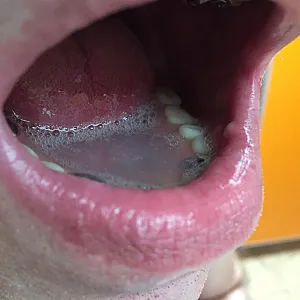 Cum gallery image
