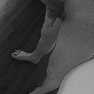 Penis gallery image
