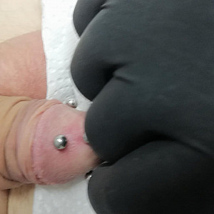 fourth piercing in my glans gallery image