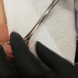 fourth piercing in my glans gallery image