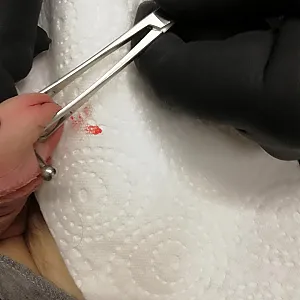 fourth piercing in my glans gallery image