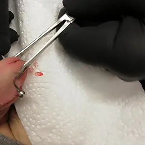 fourth piercing in my glans gallery image