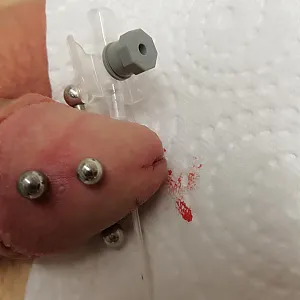 fourth piercing in my glans gallery image