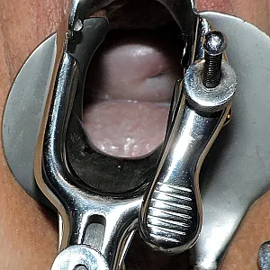 Steffis geiles Fotzenloch mit Speculum Galeriebild