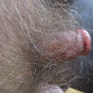 my cock gallery image