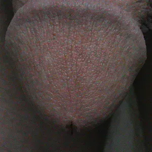 my cock gallery image