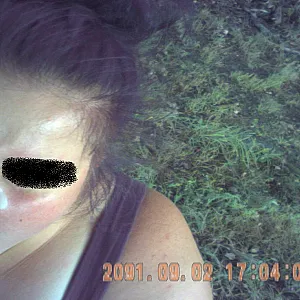 facial gallery image