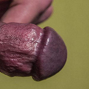 My Penis and I gallery image