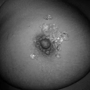 Nipples gallery image
