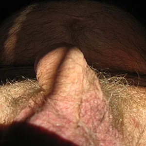 My dick gallery image