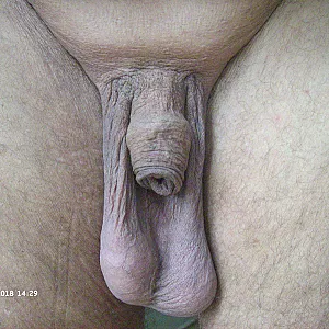 long balls gallery image