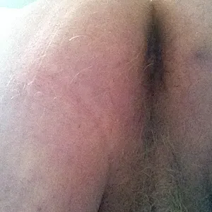 my cock gallery image