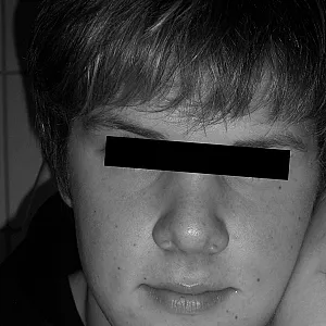 Teil II Galeriebild