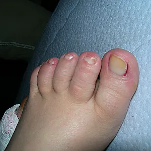my gf gallery image