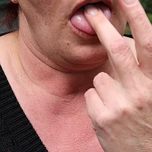 wicki eine zeigegeile frau teil 01 Galeriebild