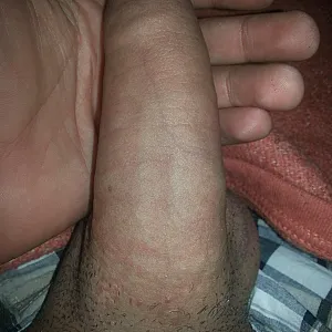 again gallery image