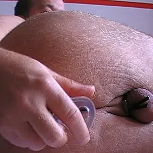 anal sedcued gallery image
