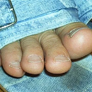 feets after work gallery image