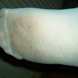 feets after work gallery image