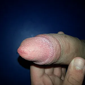 my cock gallery image