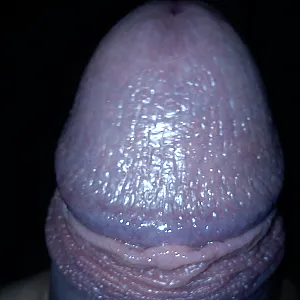 closeups gallery image
