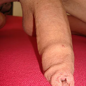 foreskinned gallery image