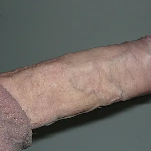 meine dick Galeriebild