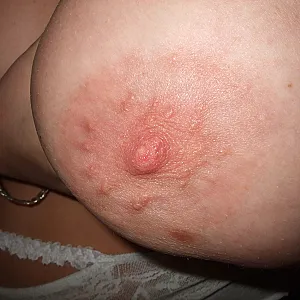 big fat tits gallery image