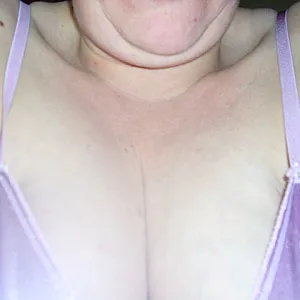 my breasts gallery image