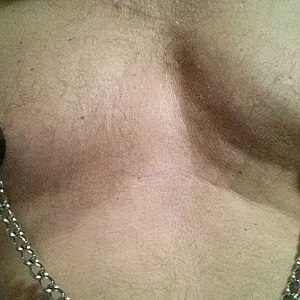 bit pain gallery image