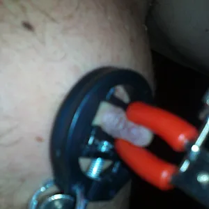 bit pain gallery image
