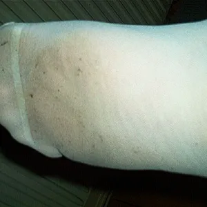 springfeets gallery image