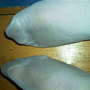 springfeets gallery image