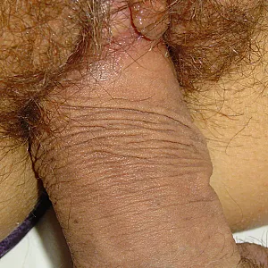 Das erste Bild von forsys's Galerie - mein igel