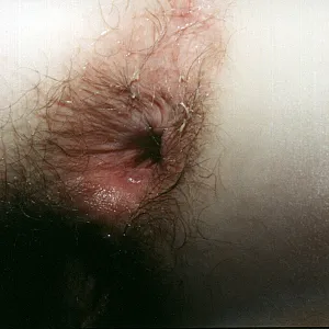 closeups from my ass gallery image