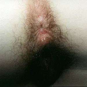 closeups from my ass gallery image