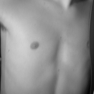 my body Galeriebild