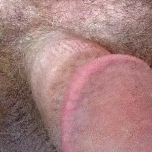 my cock gallery image