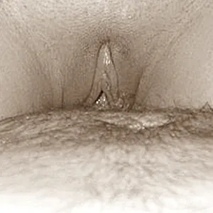 my first userdate gallery image