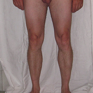 Schamhaare ab Galeriebild