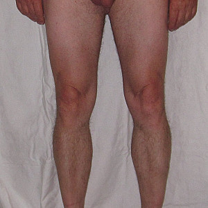 Schamhaare ab Galeriebild