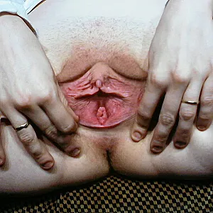 MUSCHI Galeriebild