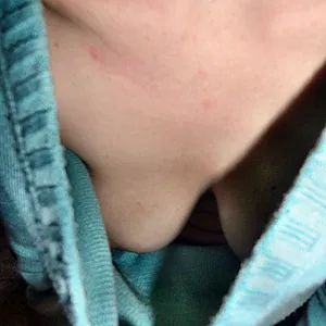 my Tits gallery image