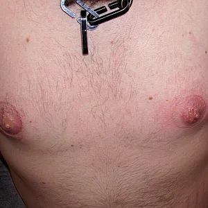 wunde Nippel Galeriebild